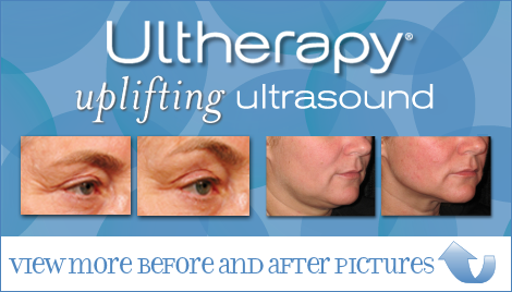Skin Tightening with Ultherapy in San Francisco | Epi Center | Ultherapybeforeafterphotos